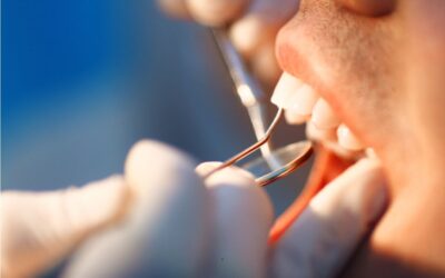 Non au relèvement du ticket modérateur pour les soins dentaires